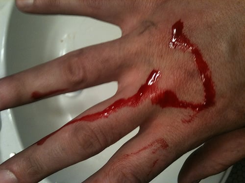 Slashed Knuckle Torn Open Knuckle